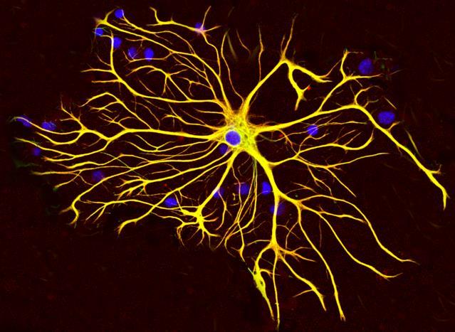 Beyinde Nöroinflamatuar hücreler Astrosit Nöral progenitör hücrelerden gelişir Yapısal bir eleman Özellikle Glutamat gibi nörotransmiterleri serbest bırakır BBB ni yapısını ayarlayankatkıda bulunan