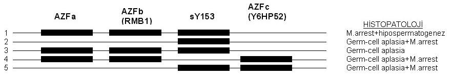 Y KROMOZOM MİKRODELESYONLARI de görülmektedir. Genellikle germ-cell aplasia ve maturasyon arresti tespit edilmekle birlikte 2 no - lu hastada %2 ve %6 hipospermatogenez alanları tespit edilmiştir.