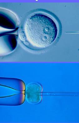 Erişkin kök hücreler: Farklı dokularda bulunan ve genelde bulundukları dokuya özgü hücrelere farklılaşma kapasitesine sahip postnatal dönemdeki kök hücreler.