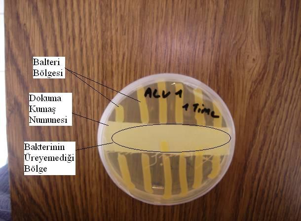 Aleovera Mikro Kapsül Katkılı Kitosan Solüsyonu Uygulanan Kumaşların Antibakteriyel Test Sonuçları AATCC 147 Metodu ile