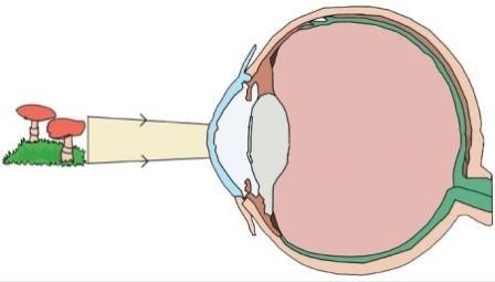Kavram haritasında sembollerin yerine hangi kavramlar yazılmalıdır? p A) İris Ağ 101. I. Damar tabaka gözü besleyen damarlar bulunur. II. Sarı benek gözün ön kısmında bulunur. III.
