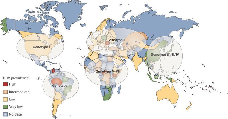 HDV genotip 1 HBV genotipi 3 Epidemiology, pathogenesis and management of hepatitis D: