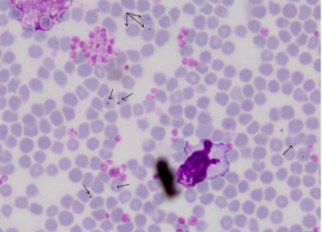 ġekil 3.1. Anaplazmozisli bir keçinin kan frotisinde A. ovis'in görünümü (100X). ġekil 3.2.
