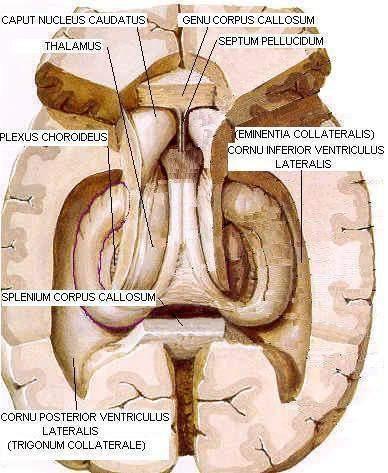 lateral ventrikülün cranium