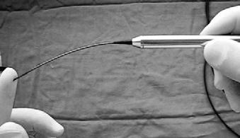 Oysa meme süt kanallarını görüntüleyebilen endoskopi cihazı (LaDuScope, Duktoskop, Mammoskop, Mastoskop vb.