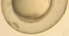 İkinci aşamada blastopor dudaklarının birleşmesinden kısa bir süre sonra önce başın arka kısmında arka-yan duvarlarının ters yüz olmasıyla optik veziküller gelişmeye başlar.