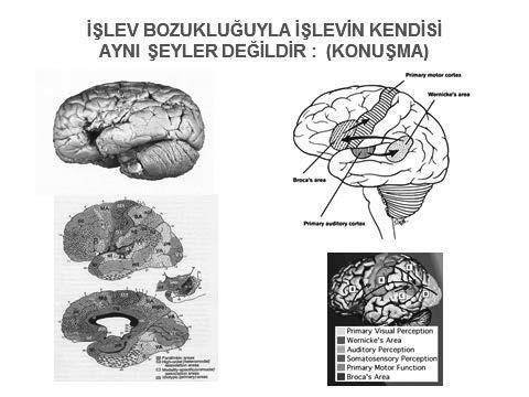 Beyin-Davranış İlişkileri Üzerine Konferanslar ve Dersler Görsel 3. Sol üst köşede Broca nın ilk otopsi hastası Leborgne ( mösyö Tan) a ait beyin görülmekte.