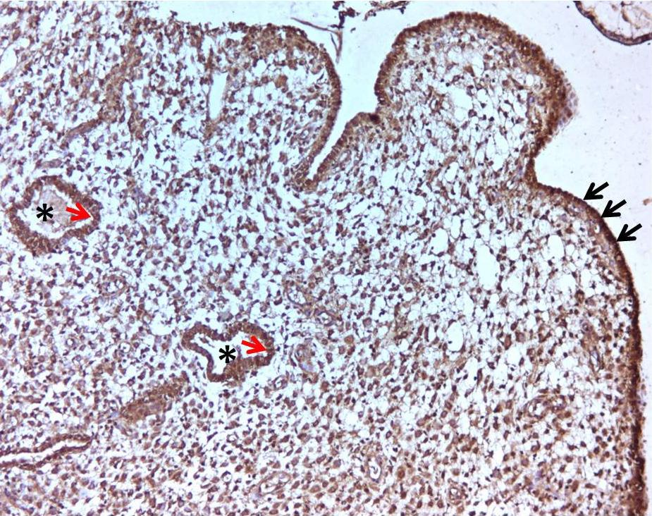 98 4.2.4. BECLİN-1 İmmünohistokimyasal Bulgular Kontrol, otoimmün (DM) ve MTHFR gruplarında endometriyumda yüzey epitel hücreleri, bez epitel hücreleri, stromal hücreler, damar endotel hücreleri,