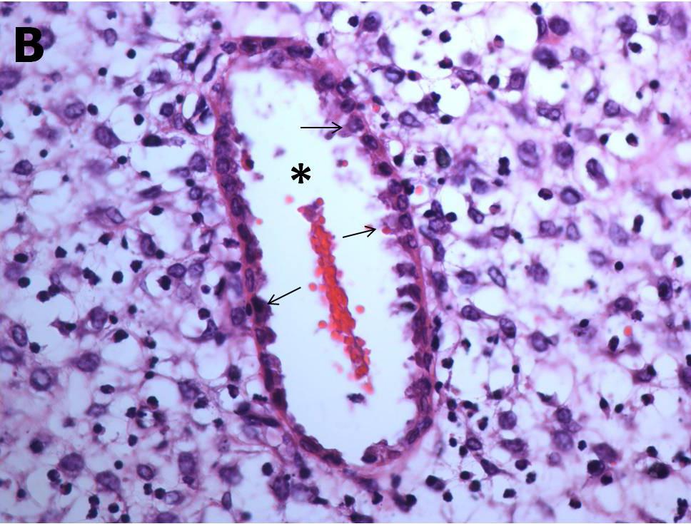 Endometriyum bezlerinin boyları uzun ve kıvrımlıydı. Bez epitel hücrelerinin çekirdekleri apikalde yerleşmişti ve yuvarlaktı.