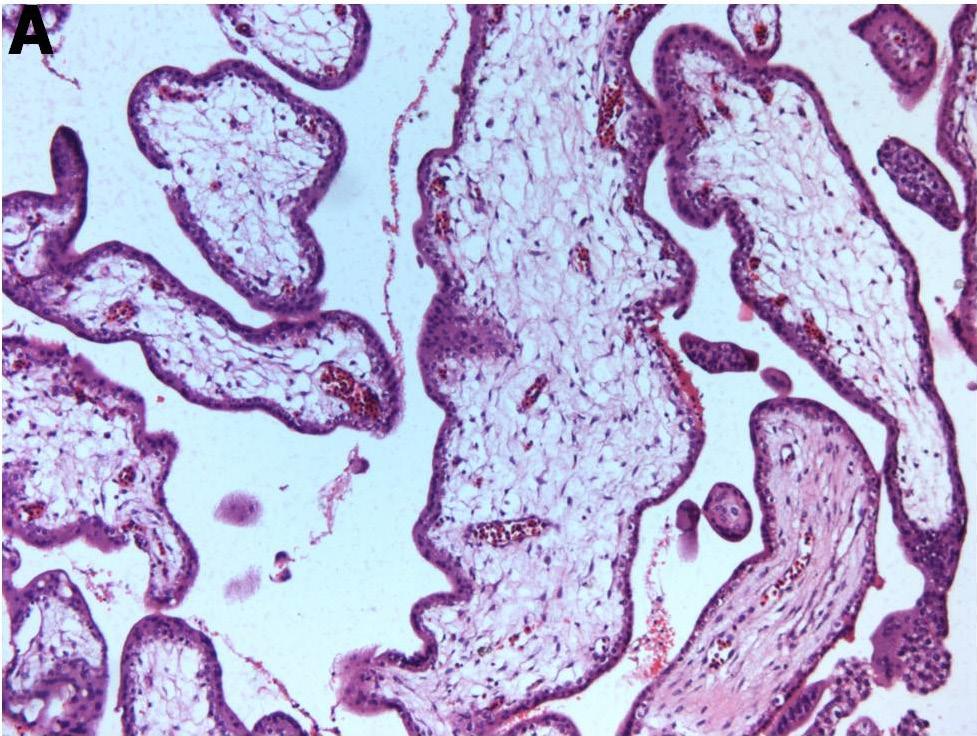 52 olarak bilinen Hofbauer hücreleri görüldü. Bağ dokusuna komşu, en içte tek sıra hücre tabakasını oluşturan sitotrofoblastların çekirdekleri soluk ve yuvarlak olarak izlendi.