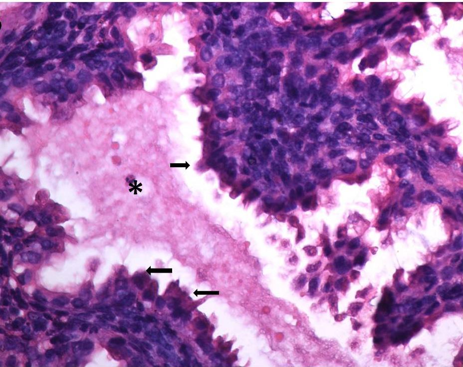 54 Şekil 4.2.1.b.2: DM grubu; Endometriyal bezlerde salgı yapan kubbemsi görünüm sergileyen bez epitel hücreleri (oklar) ve salgısı (yıldız), (Hematoksilen-Eozin X400).