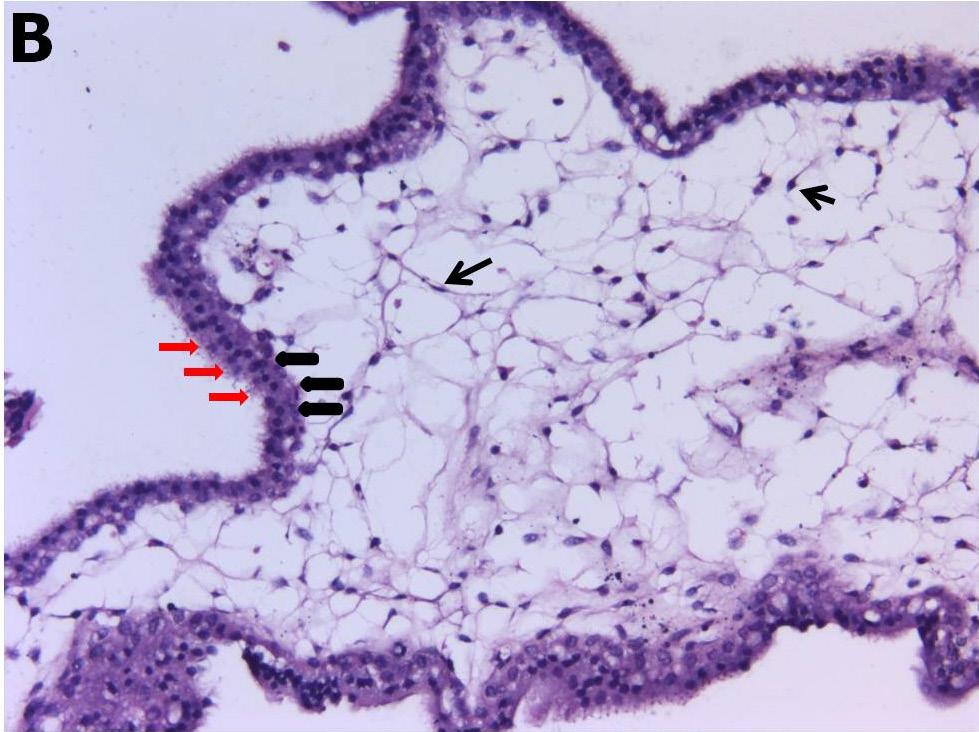 büyütmesinde sinsityotrofoblastlar (kırmızı oklar),