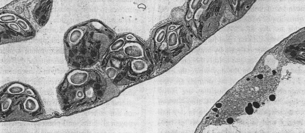 10.5). Şekil 10.4. Fotosentez sonucu nişasta tanecikleriyle dolmuş bir mezofil hücresi (Kozlowski ve Pallardy, 1997).