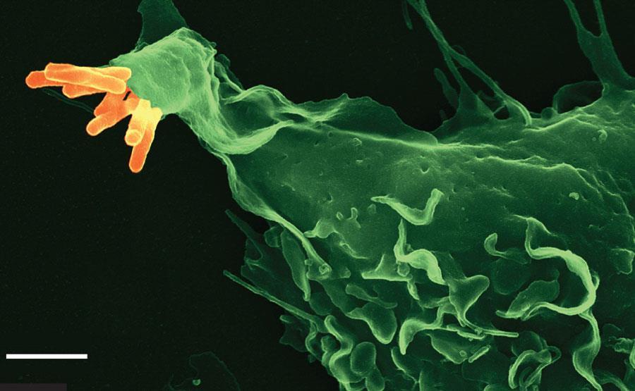 İlk Temas Alveolar makrofajlar; memeli hücrelerinde bulunmayan fakat mikrobiyal
