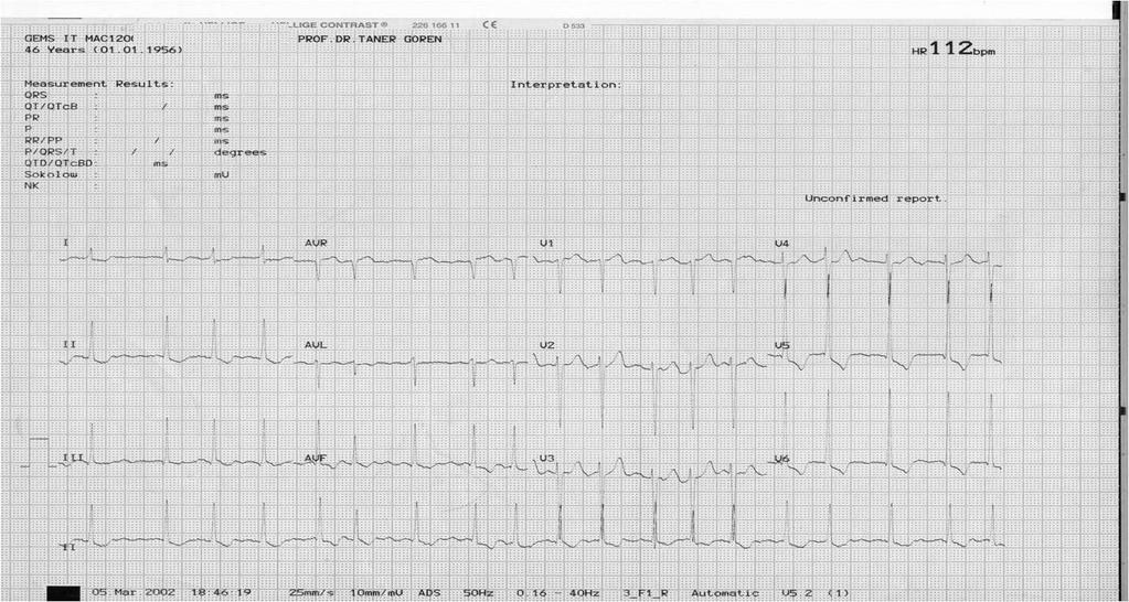 Patolojik bir EKG: QRS genişliği normal(ritmin supraventriküler kaynaklı olduğunu gösterir).