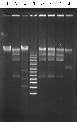 Şekil 4.2.a İnsan kaynaklı suşların plazmid içerikleri 2 BH97 (kb): 21.9, 17.3, 12.8 ve 5.8 4 M ccc Plazmid DNA Marker (kb): 16.2, 14.1, 12.2, 10.2, 8.0, 7.2, 6.0, 5.