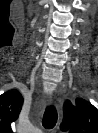 multicentre study.