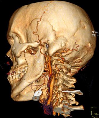 Polytrauma of the