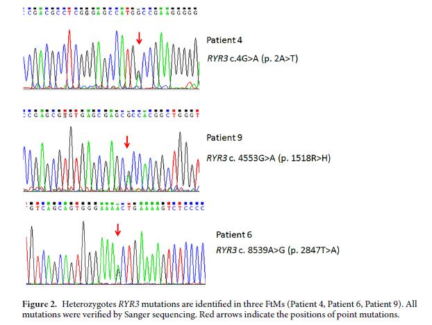 Han Çin toplumundan 9 FtM (Tüm genom sıralaması) ve 4 MtF CD bireyin (Tüm exon sıralaması) genetik analizi; İon transport genlerindeki non-synonym varyantlar FtM ve MtF gruplarında anlamlı düzeyde