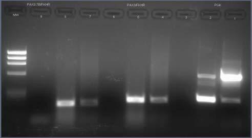 RT PCR Tümör Hücresi RNA İzolasyonu