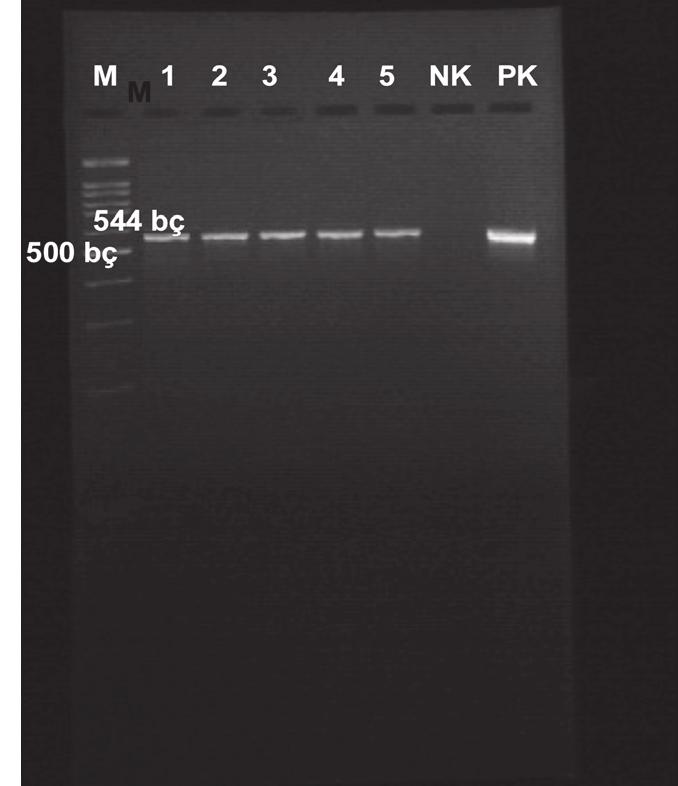 Türk Mikrobiyol Cem Derg 46(2):88-96, 26 a) b) Şekil. PCR sorası CTX-M ezimlerii agaroz jel elektroforez görütüsü.