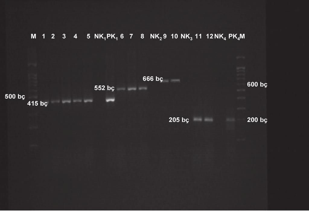 (b) -5: İzolatlarda çoğaltıla CTX-M- grubu (45 bç), NK: CTX-M- grubu egatif kotrol, PK: CTX-M- grubu pozitif kotrol, 6-8: İzolatlarda çoğaltıla CTX-M-2 grubu (552 bç), NK2: CTX-M-2 grubu egatif
