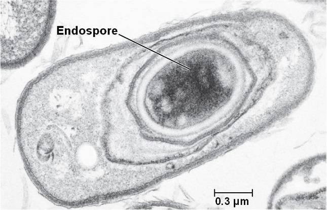 ENDOSPOR OLUŞUMU Uygun olmayan ortam koşullarında yaşamlarını devam ettirebilmek için ENDOSPOR