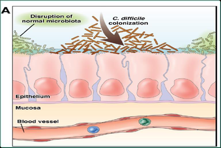 C. difficile ishaline neden olan antibiyotik ve antineoplastik ilaçlar Sıklıkla Klindamisin, Ampisilin, Amoksisilin, Sefalosporinler(2. ve 3.