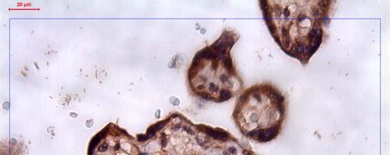 Resim 17: Caspase 9 boyaması