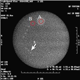 Çocuk kafa incelemeleri için CNR > 1.0 Çocuk abdomen incelemeleri için CNR > 0.5 Şekil 3.7 CNR ve düşük kontrast ayırma gücü testi için alınmış modül 2 görüntüsü.