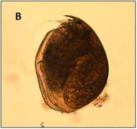Ephippium içinde bir ya da iki yumurta bulunabilir. Partenogenetik çoğalmada yumurta sayısı türün büyüklüğüne göre değişiklik gösterebilir (Şekil 2.8) Şekil 2.