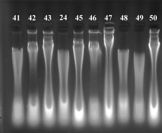 İzole edilen DNA lar %1 lik agaroz jel elektroforezi ile yürütülerek UV