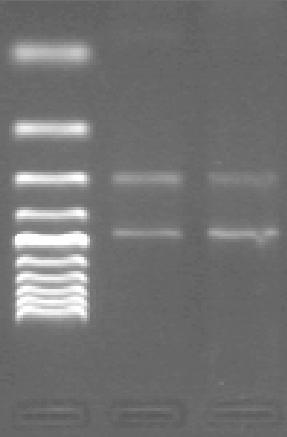89 Şekil 3.10. İki primer çifti kullanılarak (PCR-CTPP) gerçekleştirilen ALDH2 gen bölgesi polimorfizmine ait amplifikasyon ürün uzunluklarının ve baz değişimlerinin şematik gösterimi.