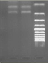 91 Şekil 3.12. İki primer çifti kullanılarak (PCR-CTPP) gerçekleştirilen ALDH2 gen bölgesi polimorfizmine ait amplifikasyon ürün uzunluklarının ve baz değişimlerinin şematik gösterimi.