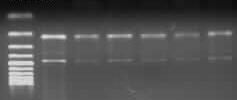 84 Şekil 3.7. İki primer çifti kullanılarak (PCR-CTPP) gerçekleştirilen ADH2 gen bölgesi polimorfizmine ait amplifikasyon ürün uzunluklarının ve baz değişimlerinin şematik gösterimi.