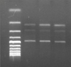 85 Aşağıdaki şekilde ise ADH2*1/2 (heterozigot) genotipli bireylere ait elde edilen jel görüntüsü görülmektedir. 219 