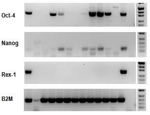 Sağlıklı grubuna ait CD34+CD38+ hücrelerde Oct-4, Nanog, Rex-1 ve B2M için PCR ürünlerinin % 2 lik agaroz jeldeki görüntüleri Şekil 11 de gösterilmektedir.