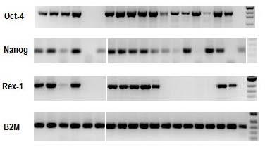AML olgularındaki CD34+CD38+ hücrelerine ait Oct-4, Nanog, Rex-1 ve B2M için PCR ürünlerinin % 2 lik agaroz jeldeki görüntüleri Şekil 14 de gösterilmektedir.
