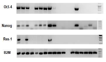 KML olgularındaki CD34+CD38+ hücrelerine ait Oct-4, Nanog, Rex-1 ve B2M için PCR ürünlerinin % 2 lik agaroz jeldeki görüntüleri Şekil 17 de gösterilmektedir.
