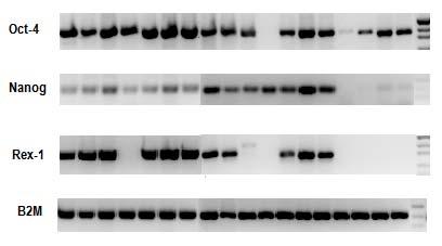 KML olgularındaki CD34- hücrelerine ait Oct-4, Nanog, Rex-1 ve B2M için PCR ürünlerinin % 2 lik agaroz jeldeki görüntüleri Şekil 18 de gösterilmektedir.