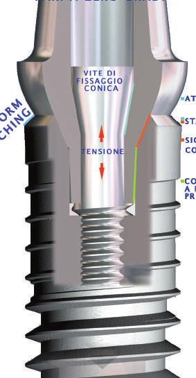 Bağlantı Şekli Dyna Helix implant sistemi tüm abutment seçenekleri ile