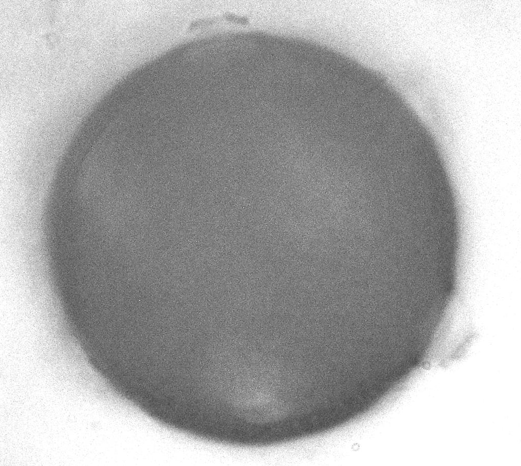 Por boyu (Plg) 7 10 µm, 7,85 ± 1,04; por eni (Plt) 7 10 µm, 7,85 µm ± 1,04, dairesel. İki por arası uzaklık (Pl-Pl) 13 15 µm, 13,75µm ± 0,79. Operculum (Op) granüllü; granüller belirgin.