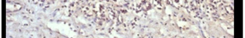 hücrelerde (ok) saptanan IL-1α