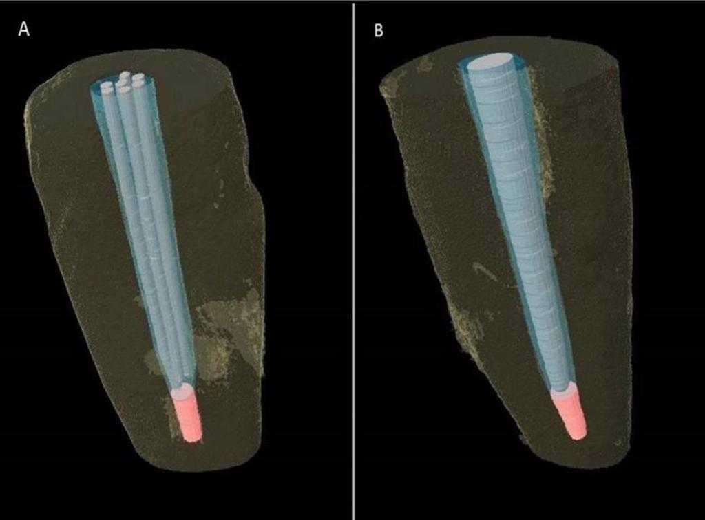 7. YAYINLAR (SCI) Micro-computerized tomography analysis of cement voids and pullout strength of glass fiber posts luted with self-adhesive and glassionomer cements in the root