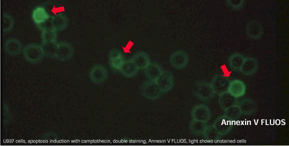 Immunohistokimyasal yöntemler Anneksin V Yöntemi: Normal hücrelerde hücre zarının sitoplazmik yüzünde bulunan fosfatidilserin (PS), Hücre apoptoza gittiğinde hücre