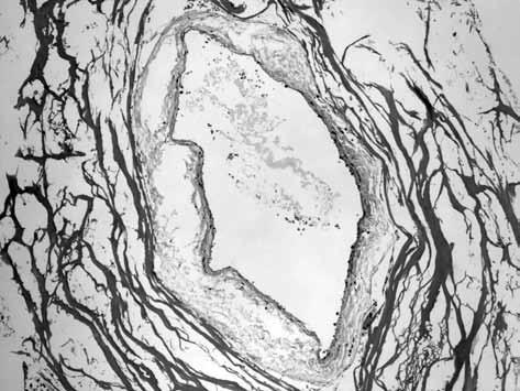 Doppler ile ölçülen ortalama kan akım hızı, greftleri örtülmeyen grupta 0. saatte proksimal de 0.93±0.33 cm/sn, distal de 0.73±0.44 cm/sn idi.