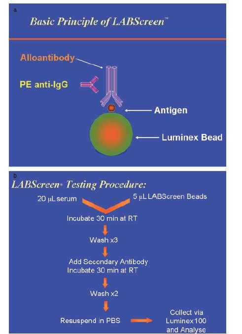 Solid Faz Immunoassay-Luminex Test serumu önce sınıf I ve sınıf II HLA antijeni kaplı mikroboncuklarla inkübe edilir Test serumundaki