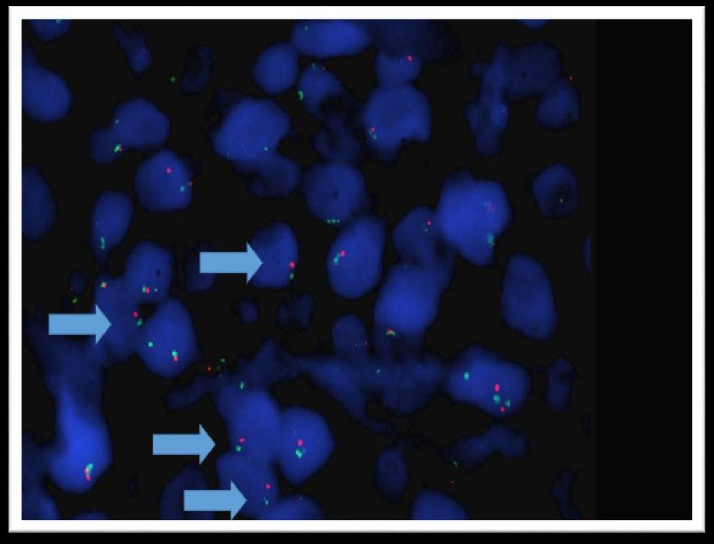 Resim 8/C: Floresan in-situ