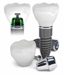 Dental İmplantlar Dental implant eksik olan dişlerin işlevini ve estetiğini tekrar sağlamak amacıyla çene kemiğine yerleştirilen ve kemikle uyumlu malzemeden yapılan yapay diş köküdür.
