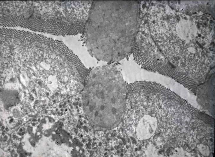 E E Mv Sg G Mv BB E Ve Sg BB G BB Ri V Ve 31 Resim 31: 1 günlük kalın bağırsak dokusunun ince kesitlerinde; yüzey epitel hücrelerinde (E) gelişkin mikrovilluslar (Mv), epitel yan yüz bağlantıları